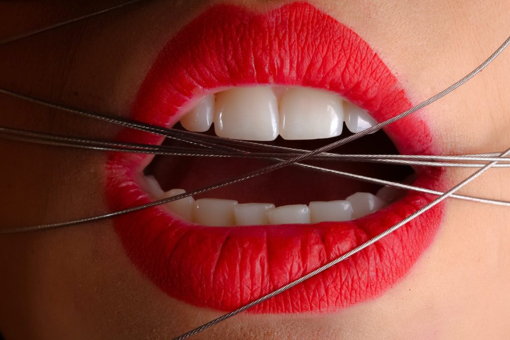 image of a mouth restricted by wires featured in an article on why roof of mouth hurts - published on healthy n better