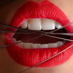 image of a mouth restricted by wires featured in an article on why roof of mouth hurts - published on healthy n better