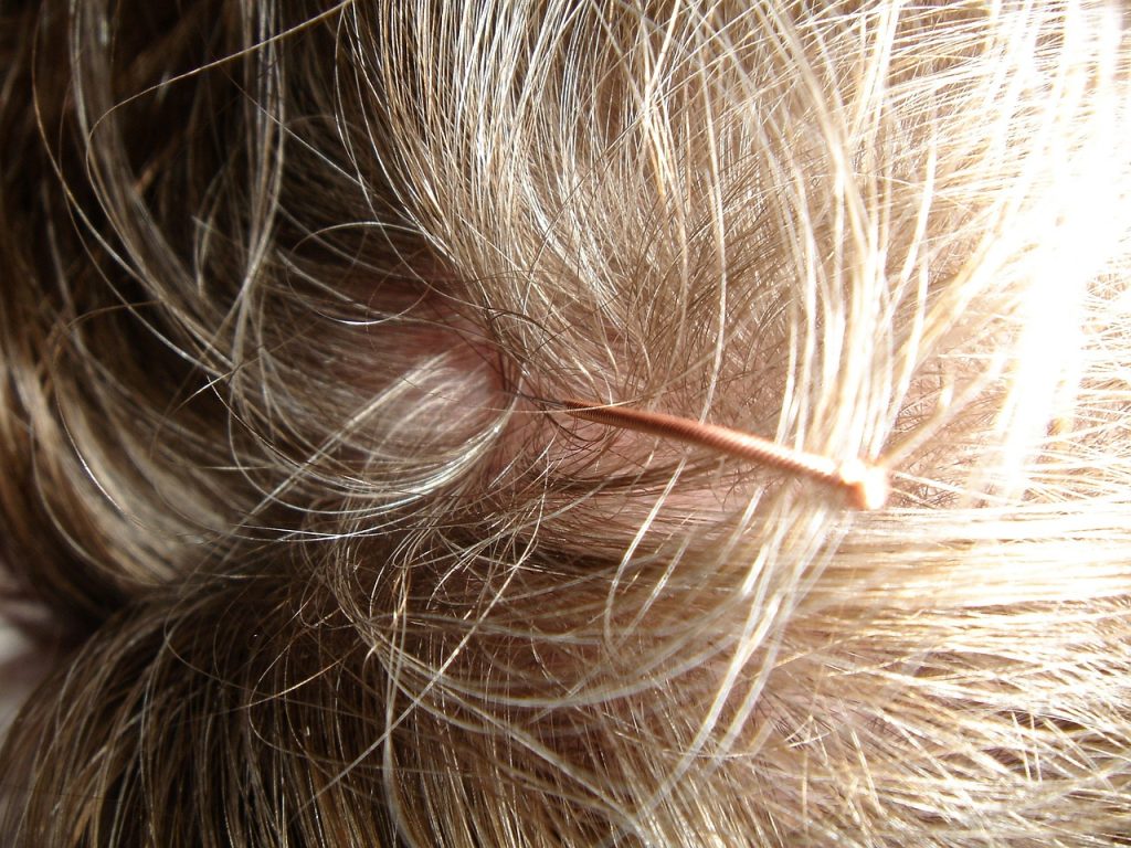 image of scalp with a tender spot featured on - tender spot on your scalp - healthy n better living