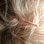 image of scalp with a tender spot featured on - tender spot on your scalp - healthy n better living
