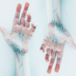 featured image of hands with varicose veins for article on worry about varicose veins published on healthy n better living